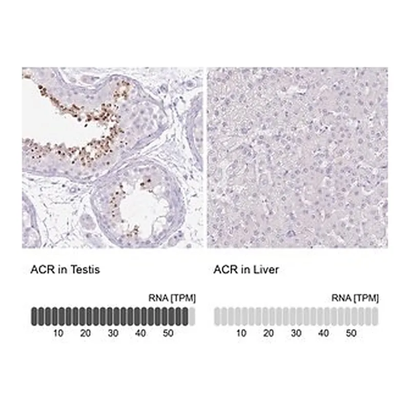 Merck Anti-ACR antibody produced in rabbit