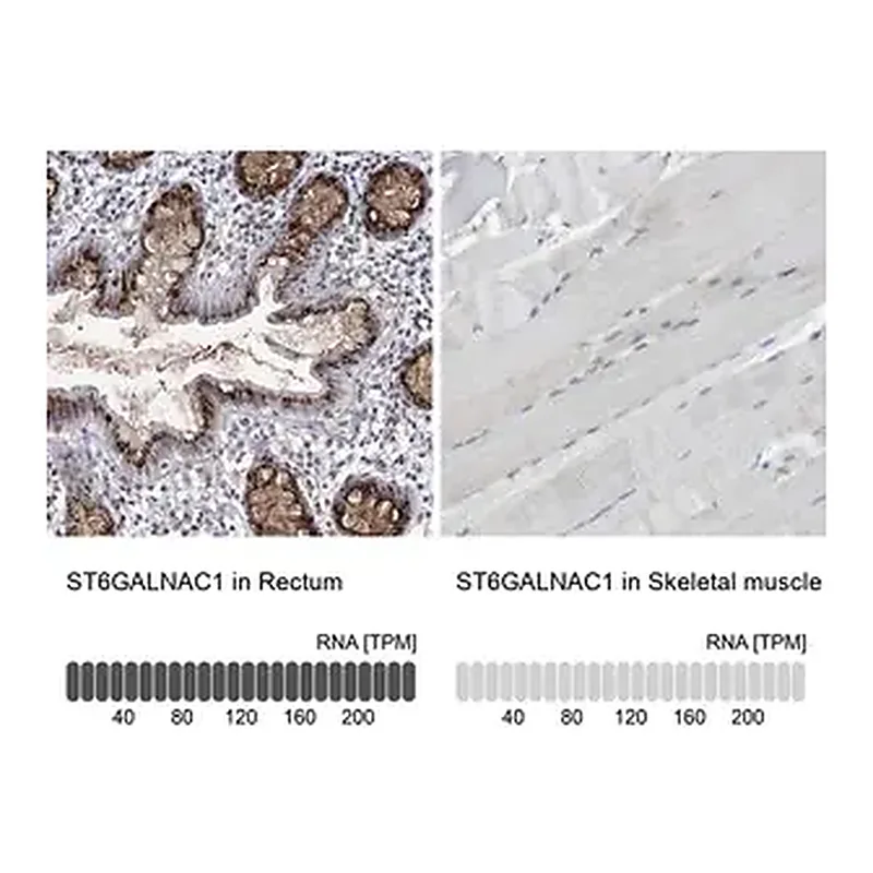Merck Anti-ST6GALNAC1 antibody produced in rabbit