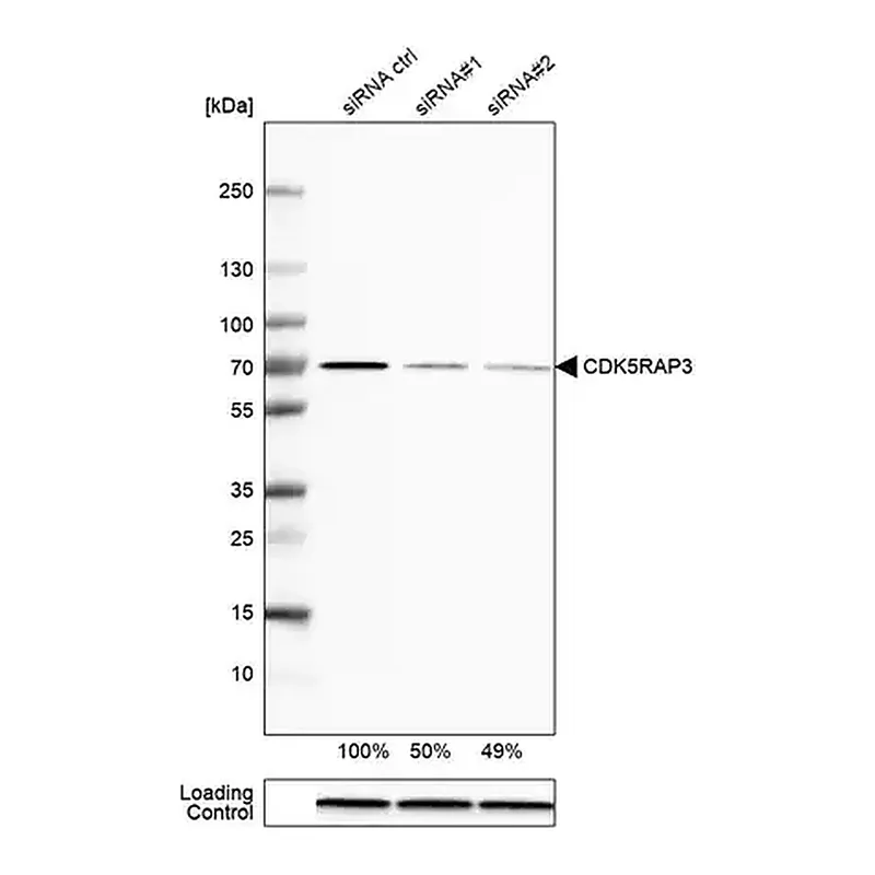 Merck Anti-CDK5RAP3 antibody produced in rabbit