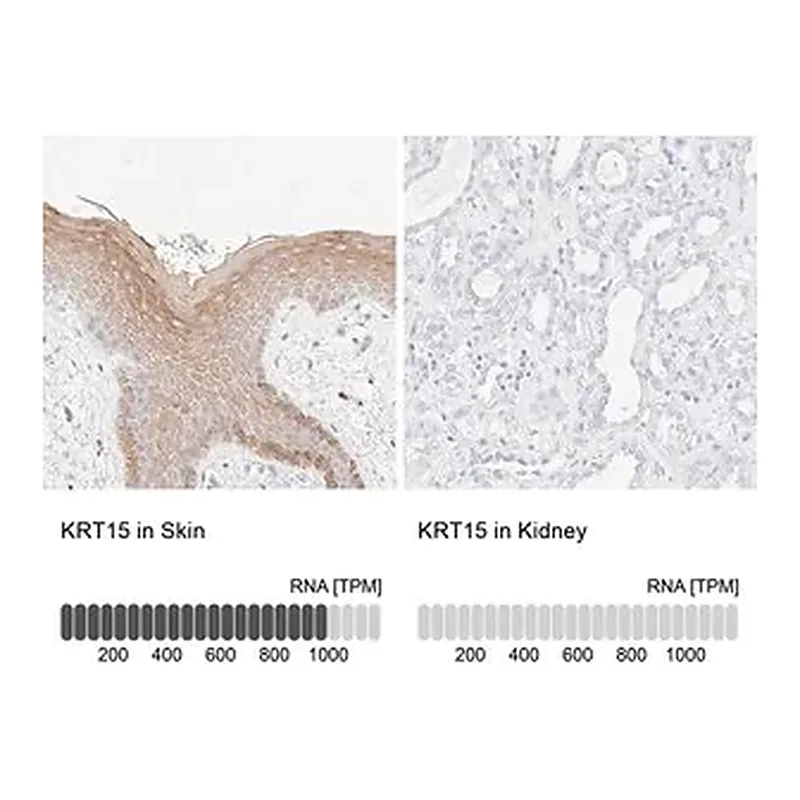 Merck Anti-KRT15 antibody produced in rabbit