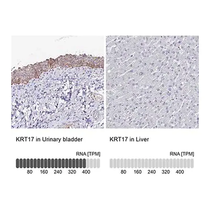 Merck Anti-KRT17 antibody produced in rabbit