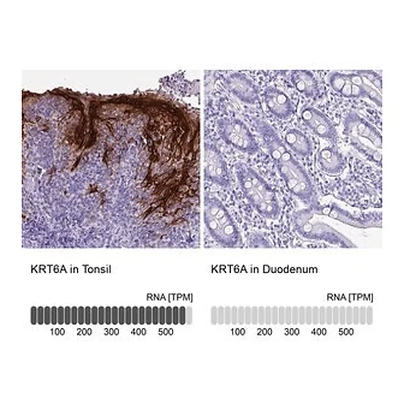 Merck Anti-KRT6A antibody produced in rabbit