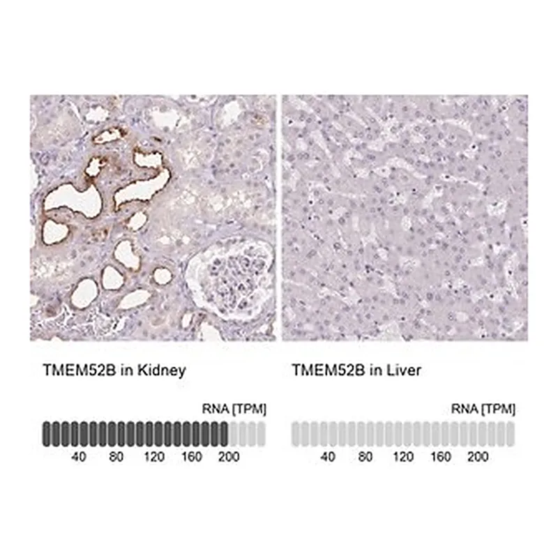 Merck Anti-TMEM52B antibody produced in rabbit