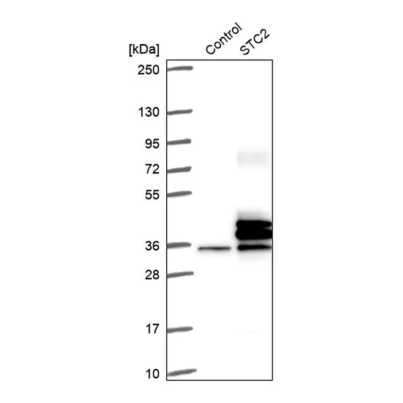 Merck Anti-STC2 antibody produced in rabbit