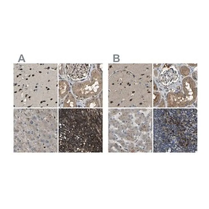 Merck Anti-ATP8B1 antibody produced in rabbit