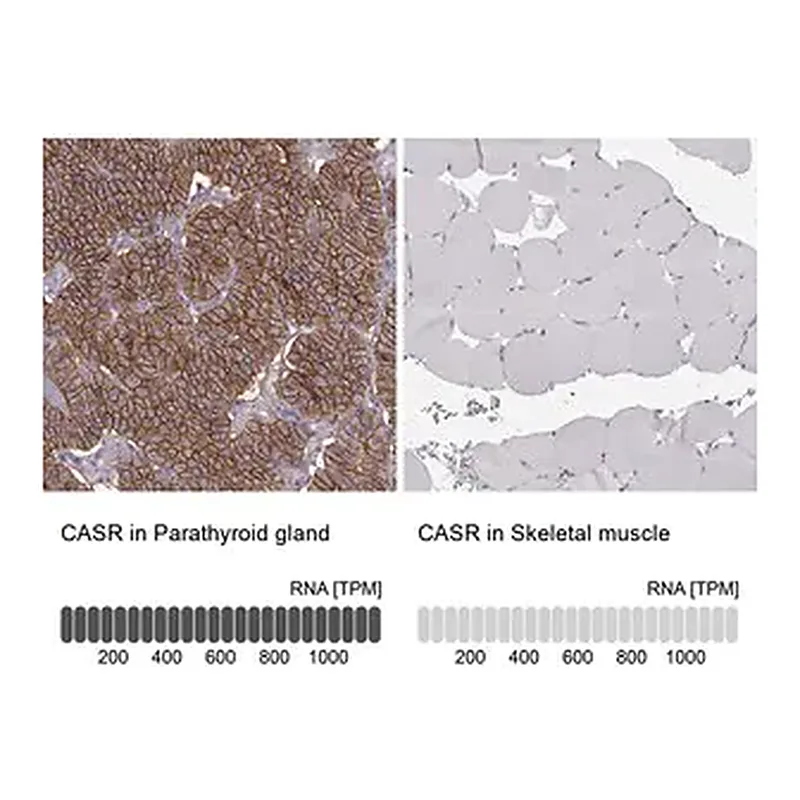 Merck Anti-CASR antibody produced in rabbit