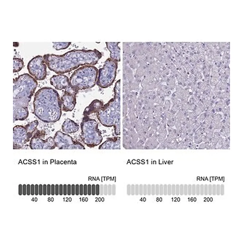 Merck Anti-ACSS1 antibody produced in rabbit