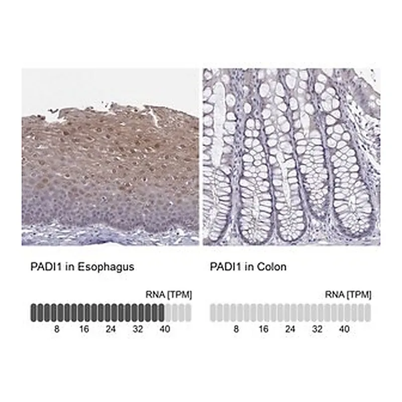 Merck Anti-PADI1 antibody produced in rabbit