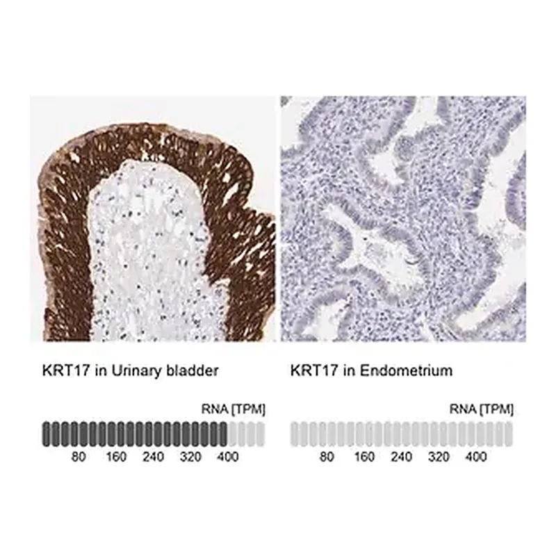 Merck Anti-JUP antibody produced in rabbit