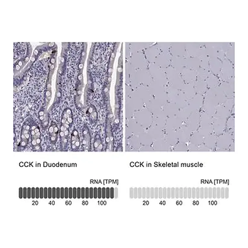 Merck Anti-CCK