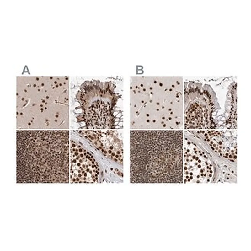 Merck Anti-PPP1R8 antibody produced in rabbit