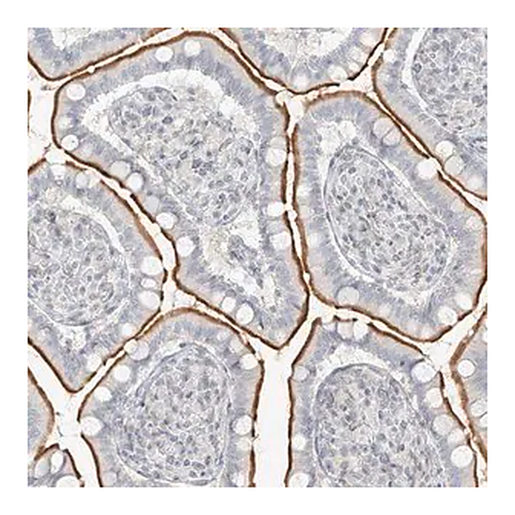 Merck Anti-OSBPL7 antibody produced in rabbit