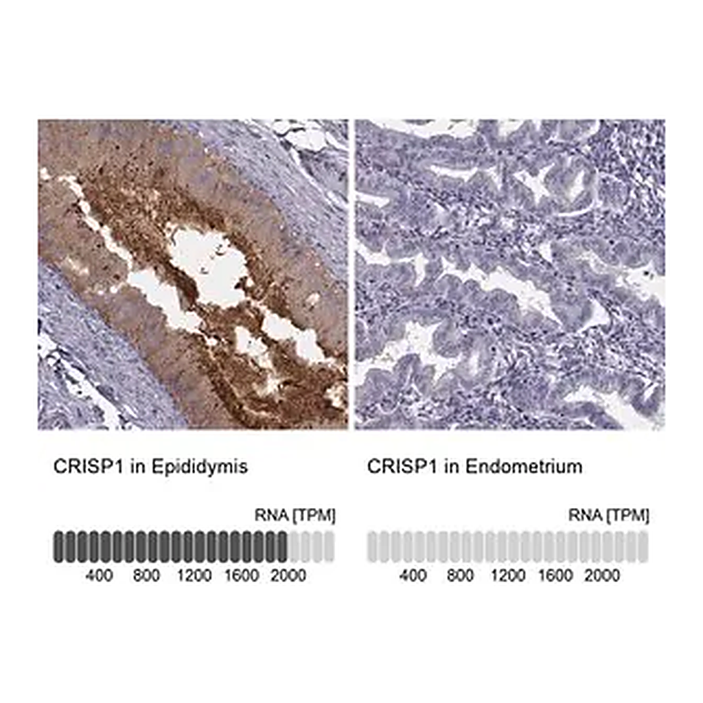 Merck Anti-CRISP1 antibody produced in rabbit