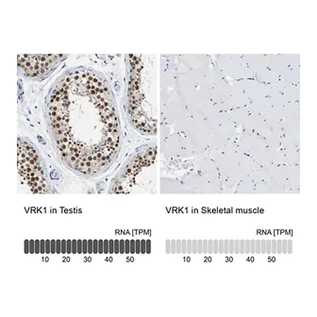 Merck Anti-VRK1 antibody produced in rabbit