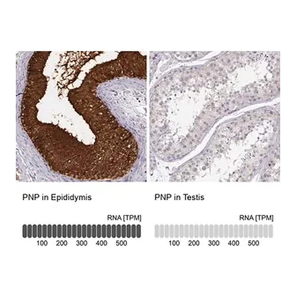 Merck ANTI-PNP antibody produced in rabbit