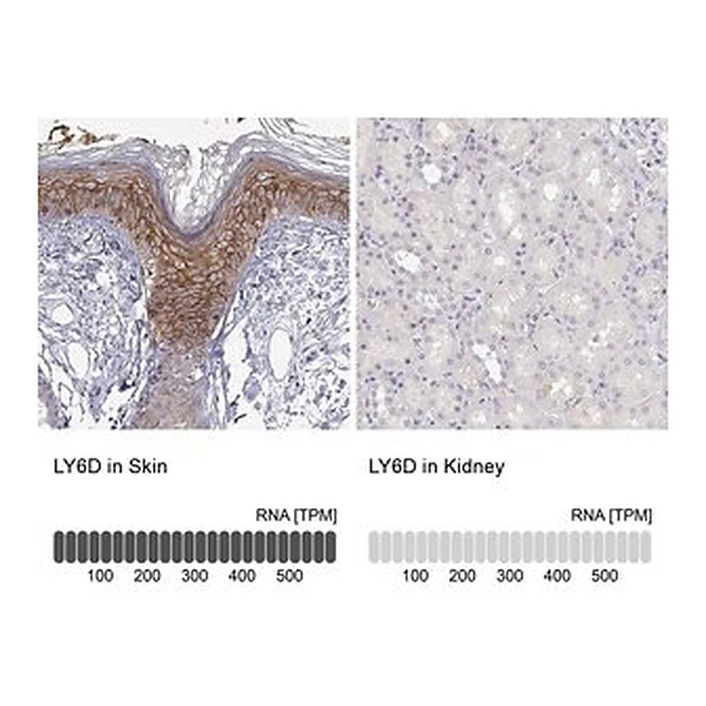 Merck Anti-LY6D antibody produced in rabbit