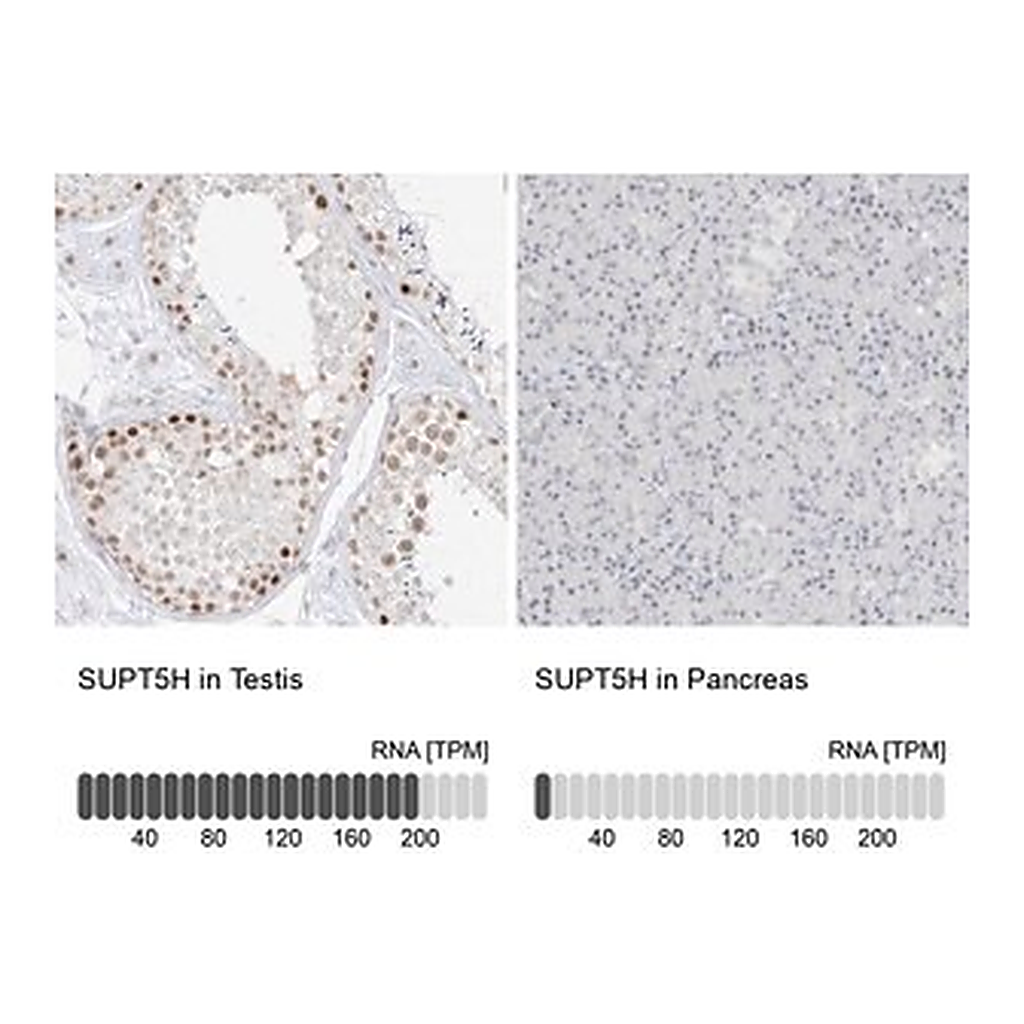 Merck Anti-SUPT5H antibody produced in rabbit