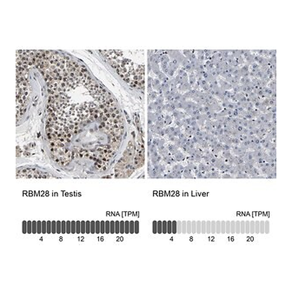 Merck Anti-RBM28 antibody produced in rabbit