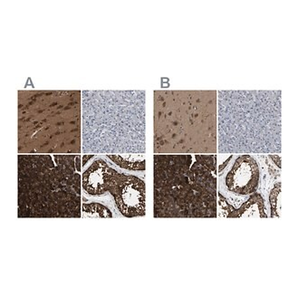 Merck Anti-GARS antibody produced in rabbit