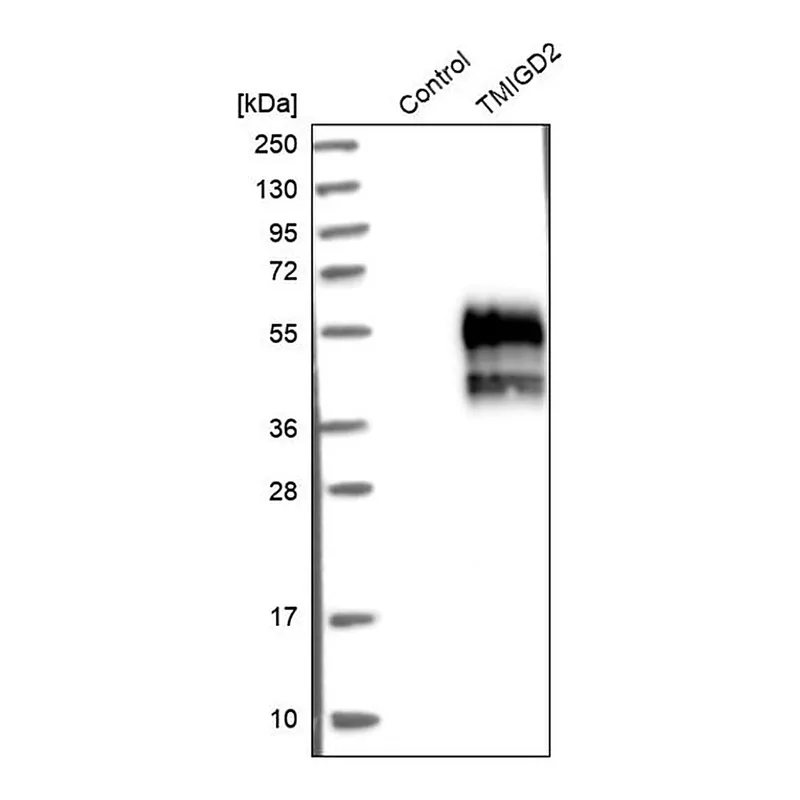 Merck Anti-TMIGD2 antibody produced in rabbit