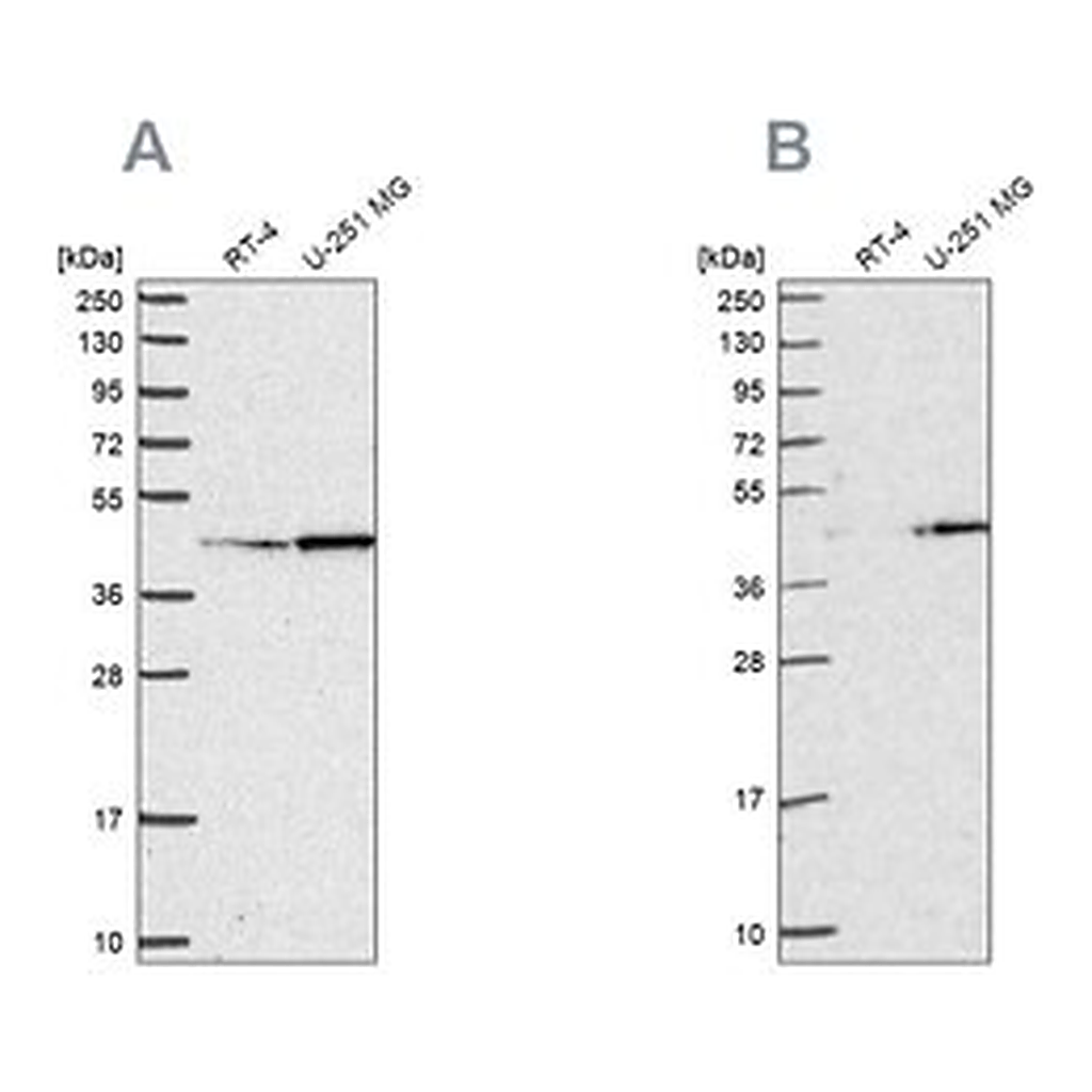 Merck Anti-WDR18 antibody produced in rabbit