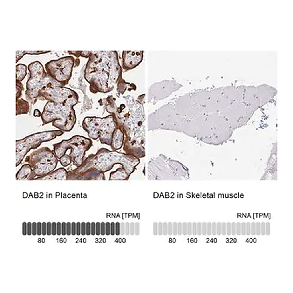 Merck Anti-DAB2 antibody produced in rabbit