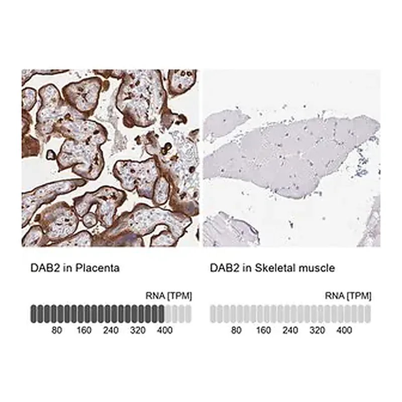 Merck Anti-DAB2 antibody produced in rabbit