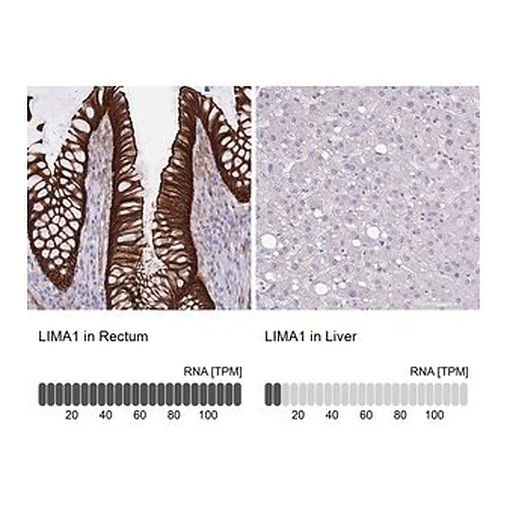 Merck Anti-LIMA1 antibody produced in rabbit