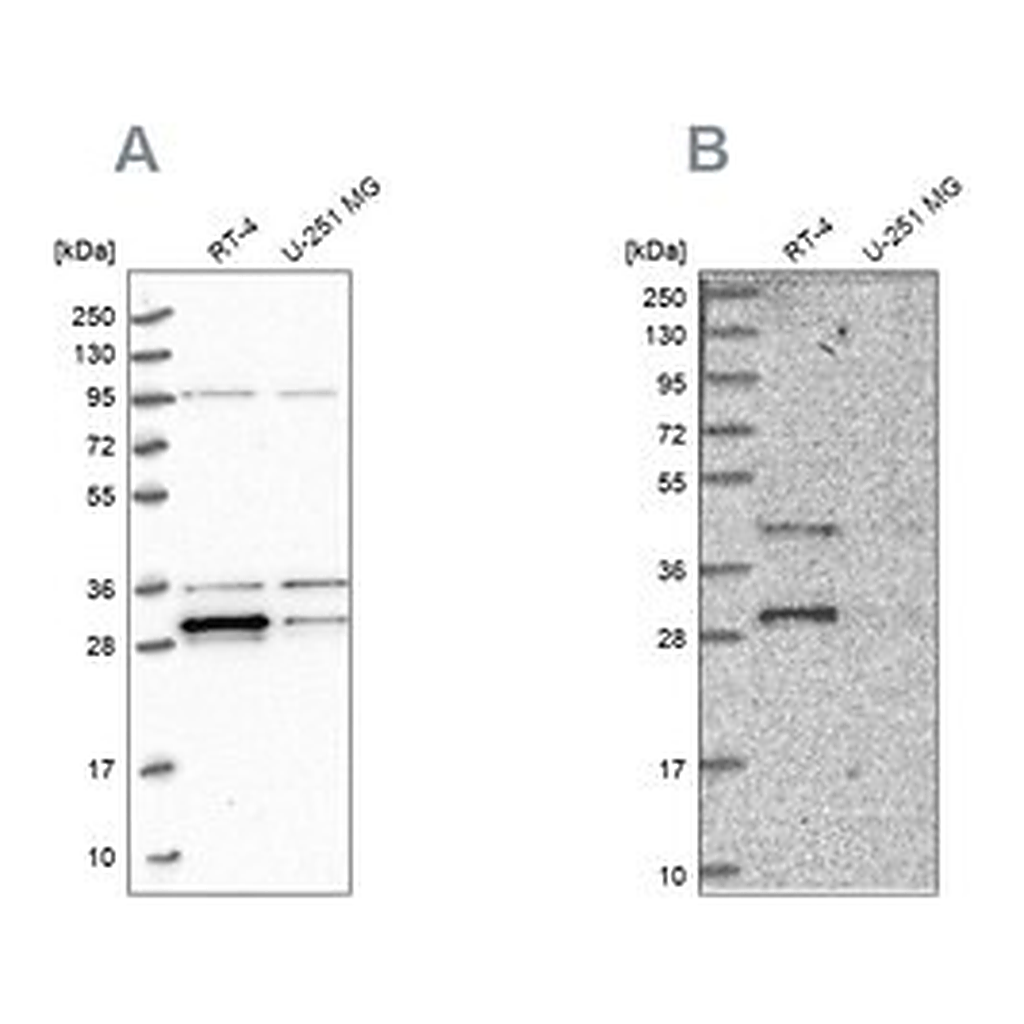 Merck Anti-PPTC7 antibody produced in rabbit