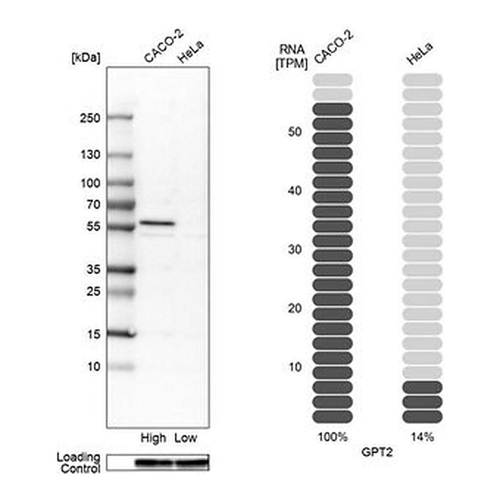 Merck Anti-GPT2 antibody produced in rabbit