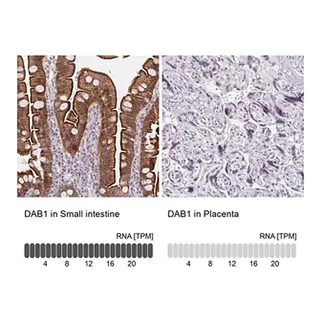 Merck Anti-DAB1 antibody produced in rabbit