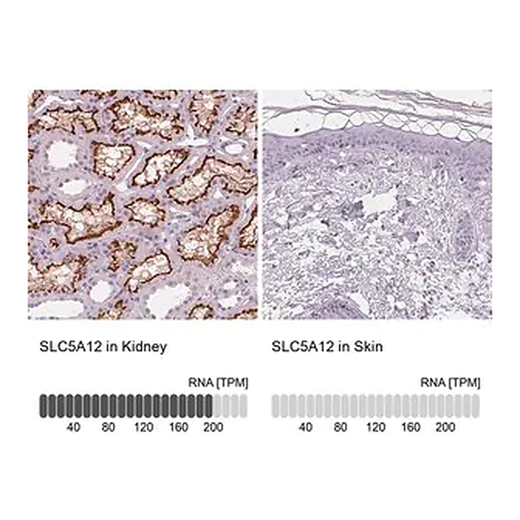 Merck Anti-SLC5A12 antibody produced in rabbit