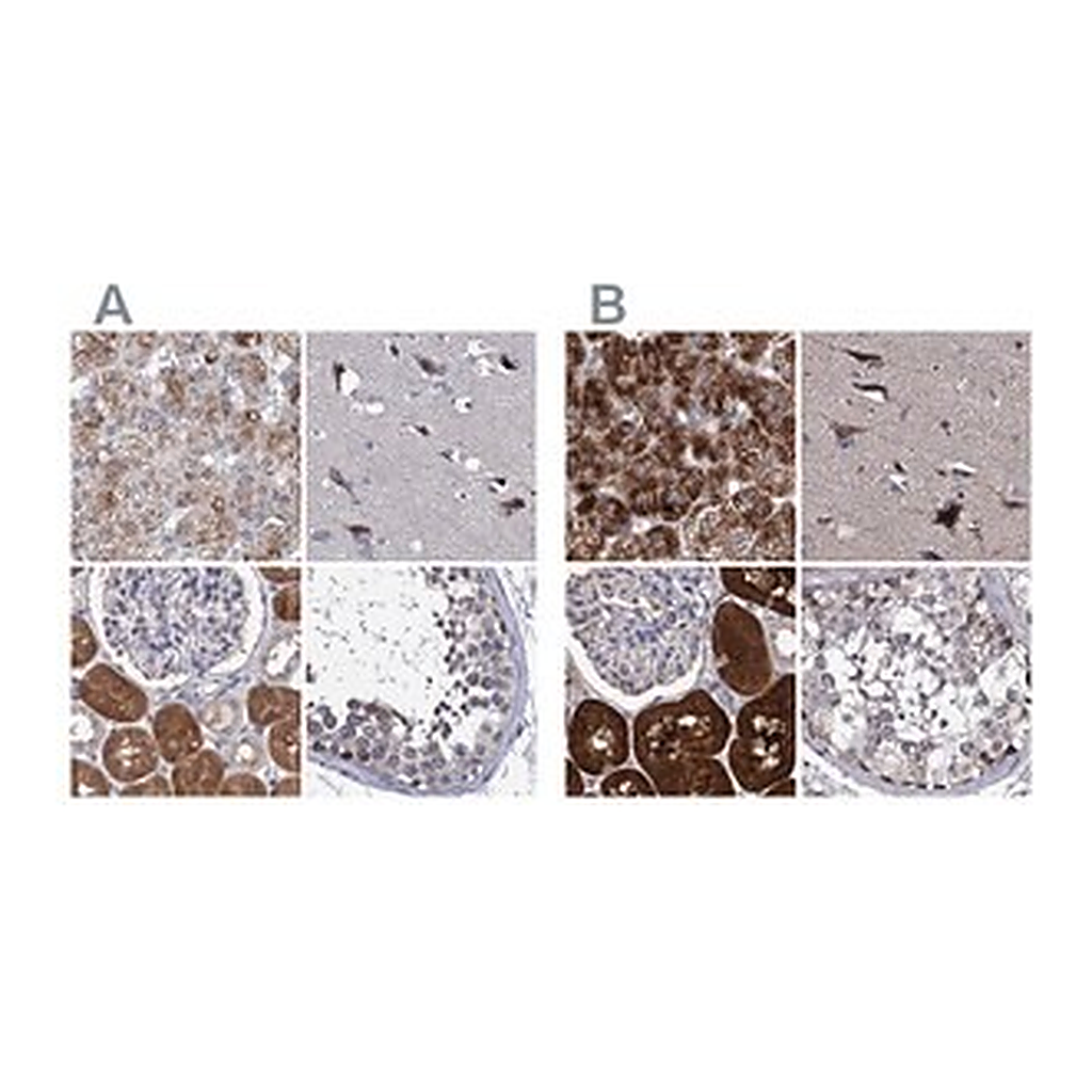 Merck Anti-CLPB antibody produced in rabbit