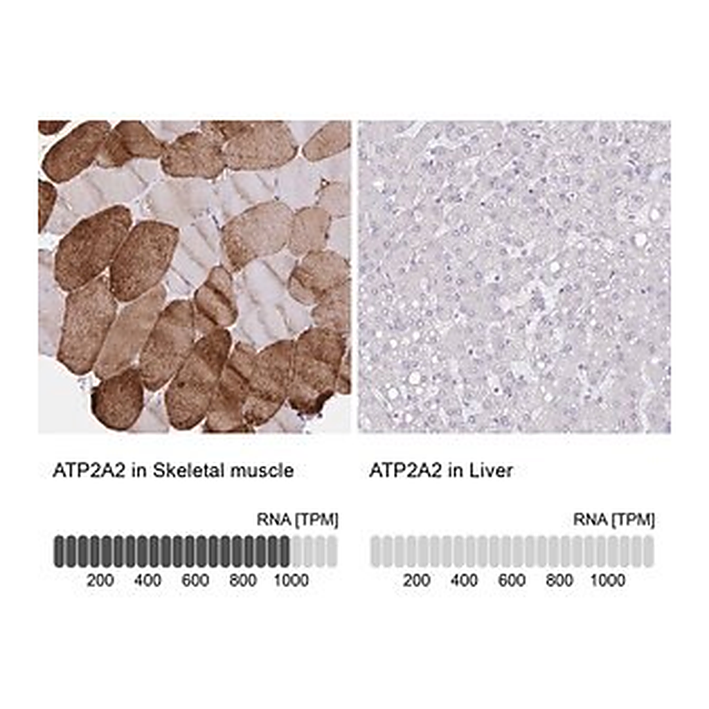 Merck Anti-ATP2A2 antibody produced in rabbit