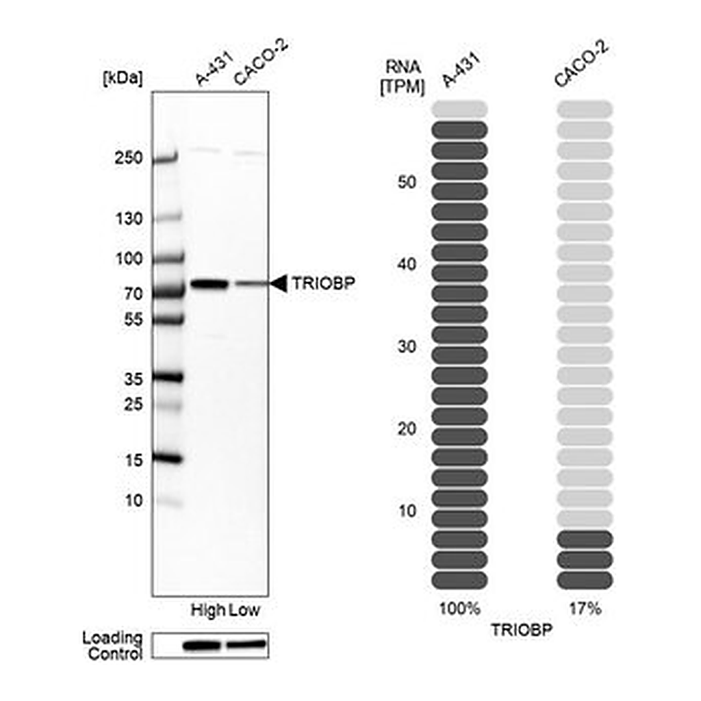 Merck Anti-TRIOBP antibody produced in rabbit