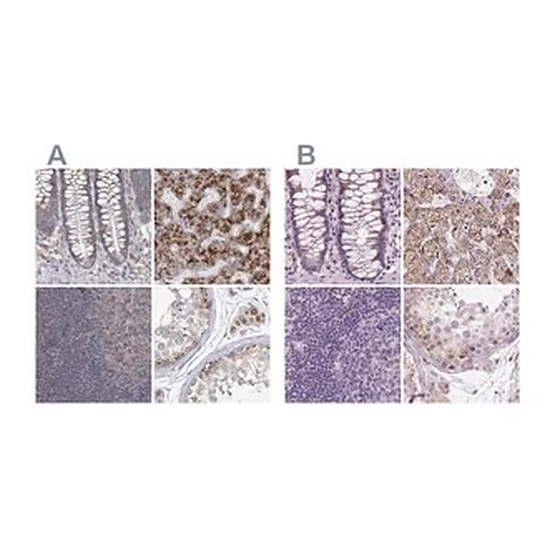 Merck Anti-ACOX2 antibody produced in rabbit