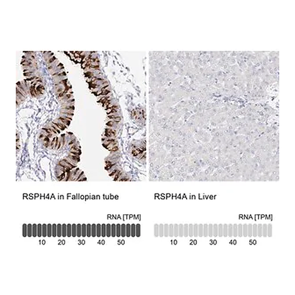 Merck Anti-RSPH4A antibody produced in rabbit