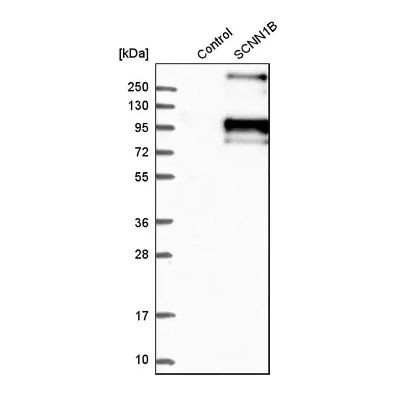 Merck Anti-SCNN1B antibody produced in rabbit