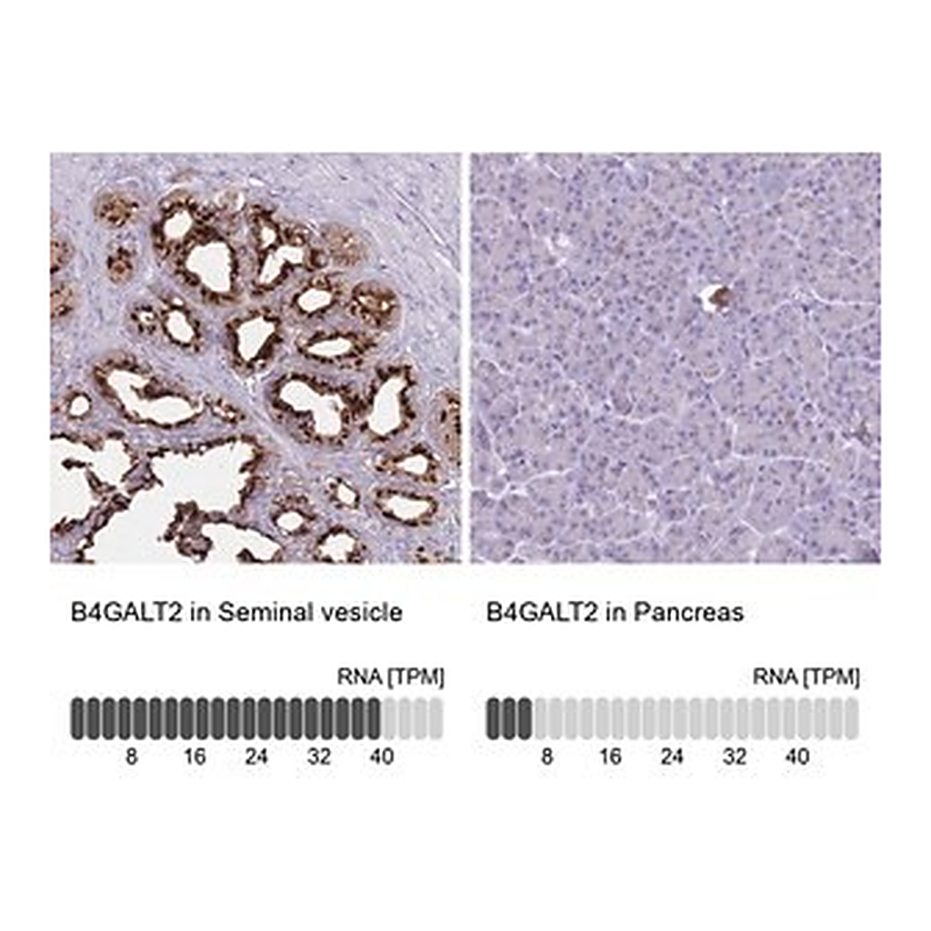 Merck Anti-B4GALT2 antibody produced in rabbit