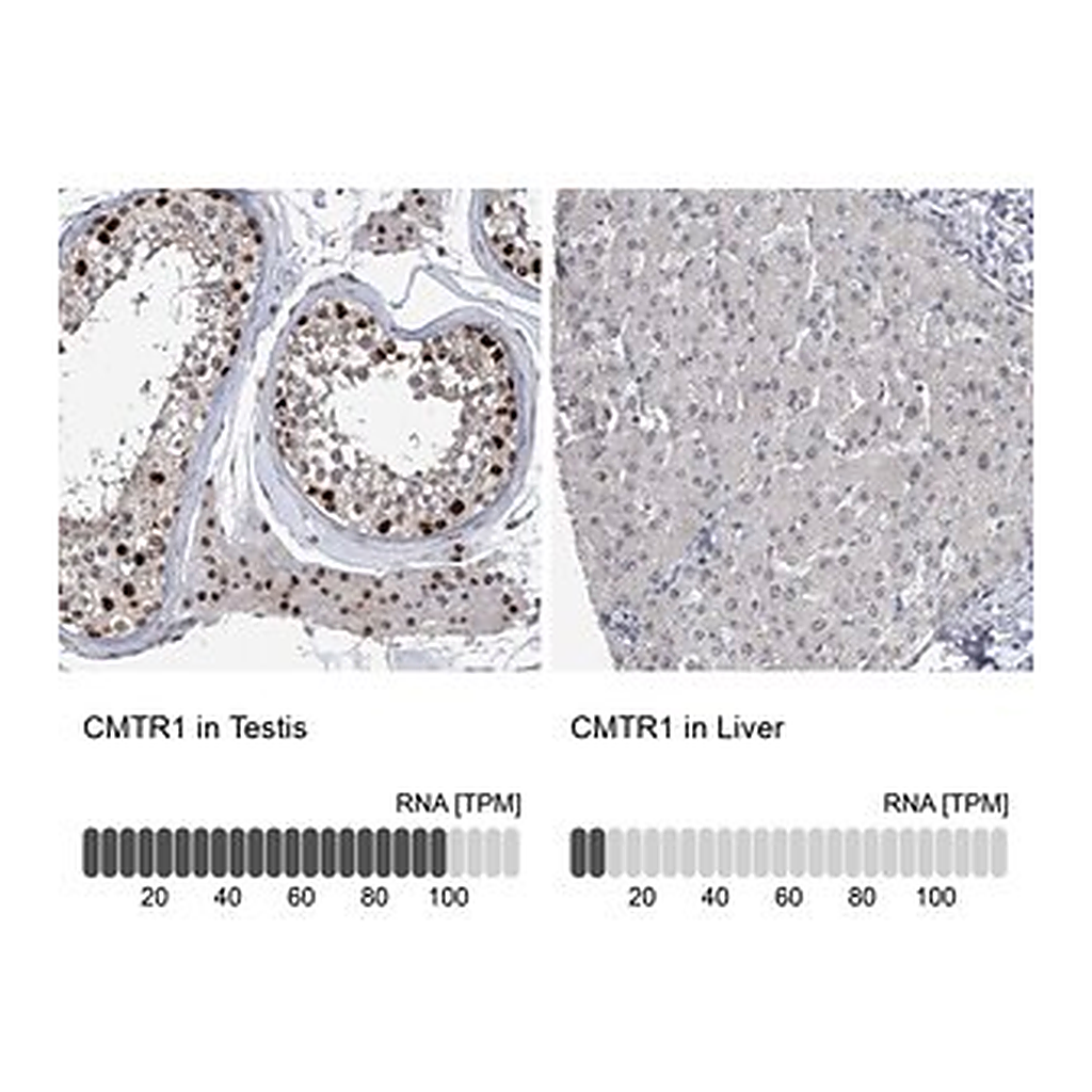 Merck Anti-CMTR1 antibody produced in rabbit
