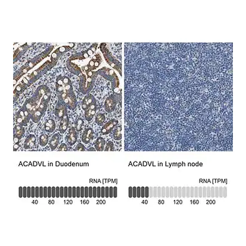Merck Anti-ACADVL antibody produced in rabbit