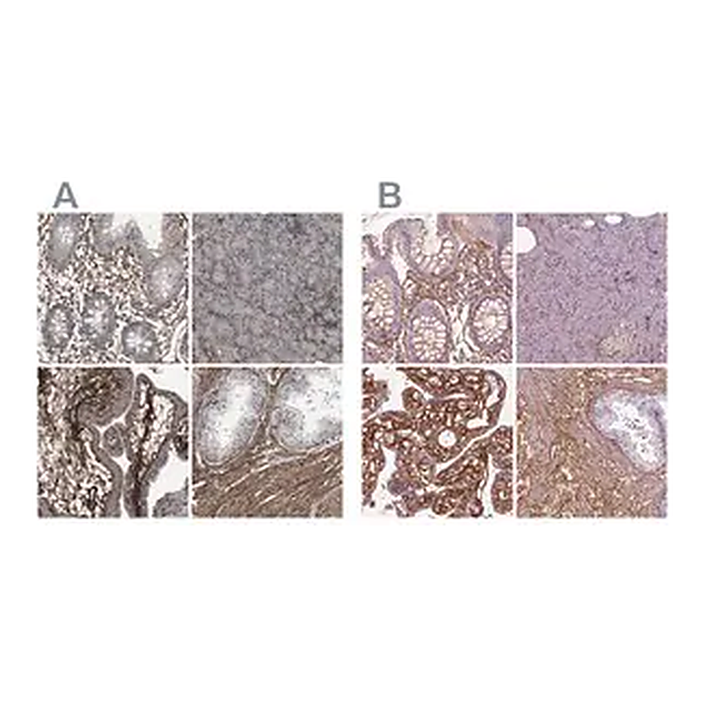 Merck Anti-COL6A2 antibody produced in rabbit