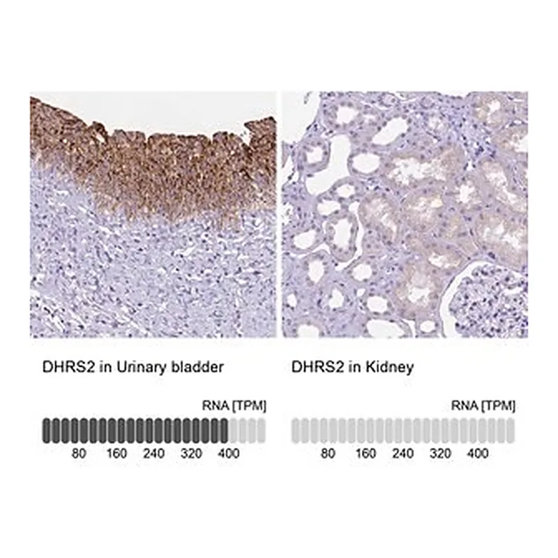 Merck Anti-DHRS2 antibody produced in rabbit