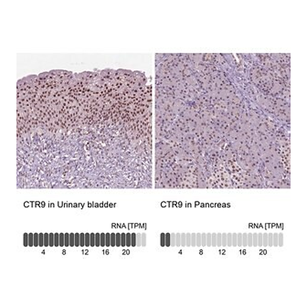 Merck Anti-CTR9 antibody produced in rabbit