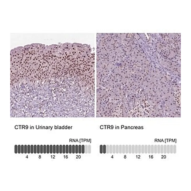 Merck Anti-CTR9 antibody produced in rabbit