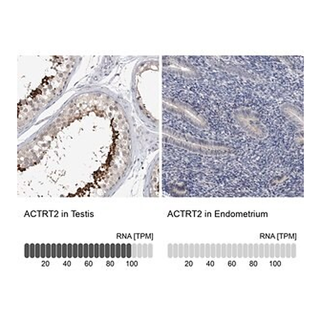 Merck Anti-ACTRT2 antibody produced in rabbit