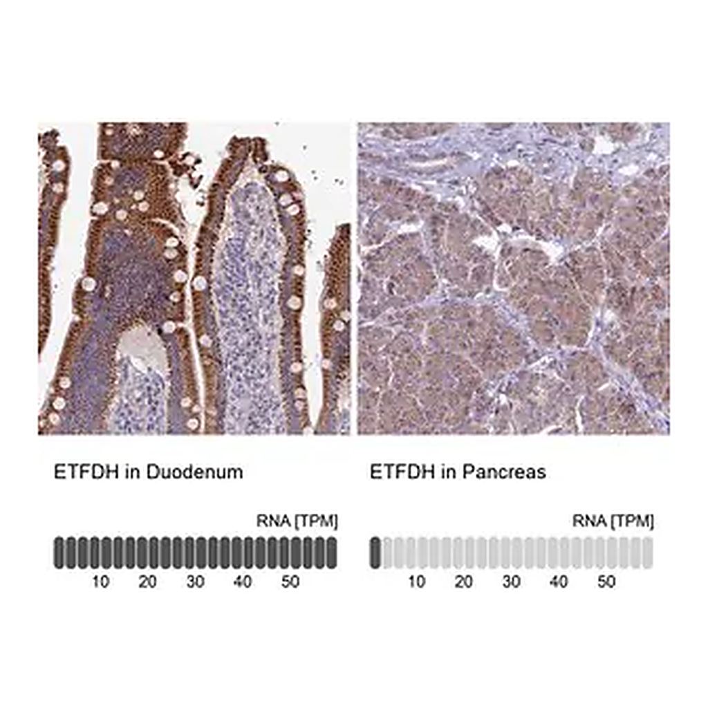 Merck Anti-ETFDH antibody produced in rabbit