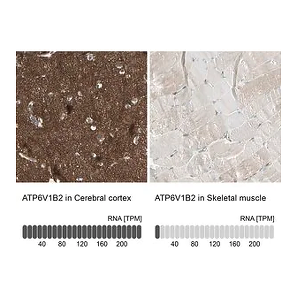 Merck Anti-ATP6V1B2 antibody produced in rabbit