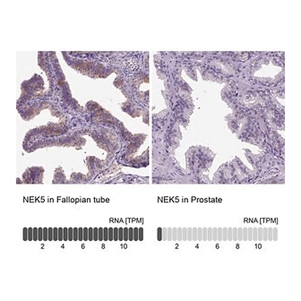 Merck Anti-NEK5 antibody produced in rabbit