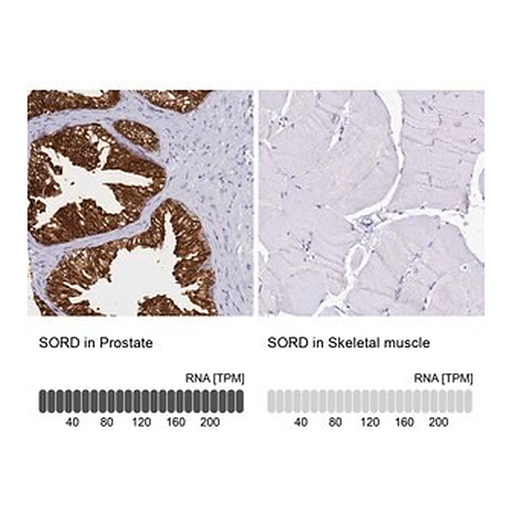 Merck Anti-SORD antibody produced in rabbit